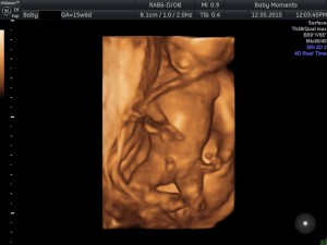 16 wks Pregnancy scan Reading